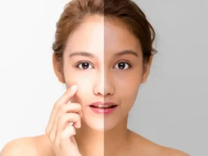 Best Skin Whitening Treatment in Sarvodaya Nagar, Kanpur