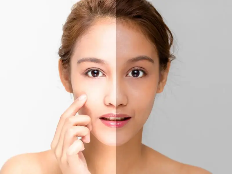 Best Skin Whitening Treatment in Sarvodaya Nagar, Kanpur