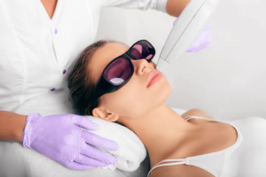 Laser Hair Remove
