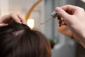Best Hair Loss Treatment Doctor in Kanpur