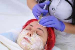 Chemical Peels Treatment in Kanpur