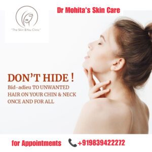 Best Laser Hair reduction in Kanpur