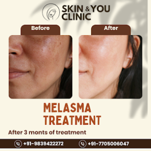 Best skin clinic near me in Kanpur