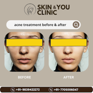 Best Skin Treatment Clinic in Kanpur