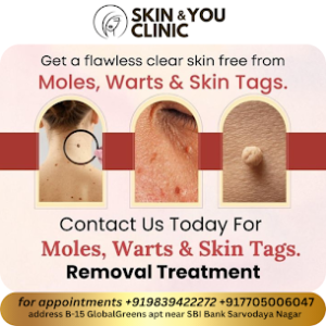 laser clinic in kanpur