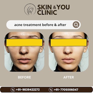 Best lady dermatologist in kanpur: +91 9839422272