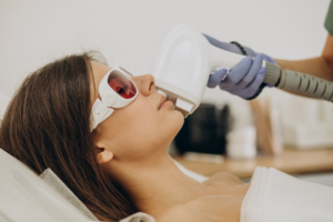 Hair Removal Clinic in Kanpur