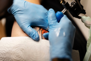 Best Tattoo removal in Kanpur Clinic In Kanpur